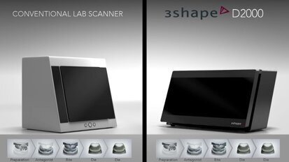 3Shape D2000 against Conventional scanner comparison