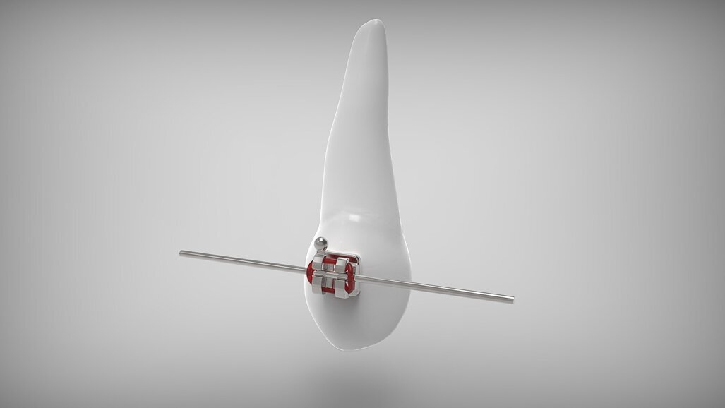 W Polsce rośnie popularność leczenia ortodontycznego