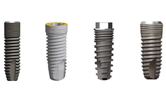 Microthreaded dental implants may preserve crestal bone