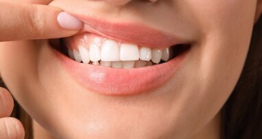 Approccio multidisciplinare alle patologie gengivali: dalla diagnosi alla terapia