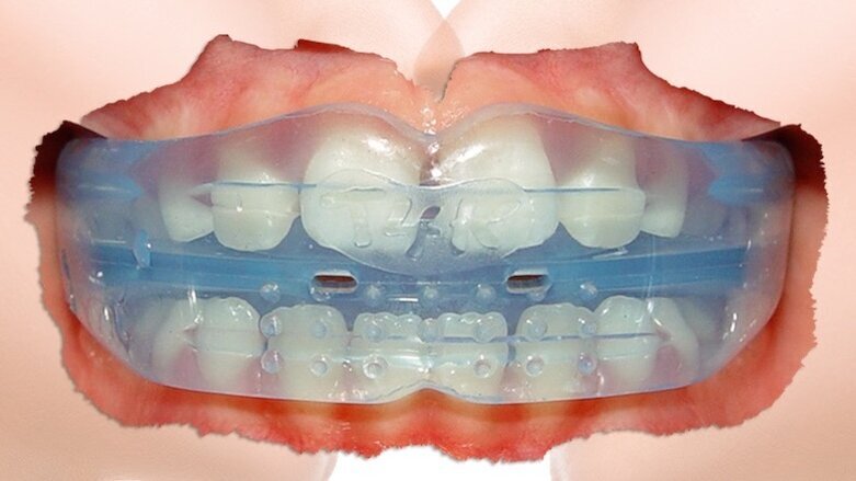 Una ortodoncia divertida