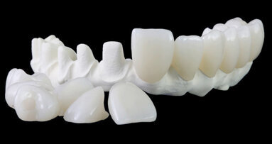 MAGICAL All on FOUR: chirurg, zubní lékař a zubní technik představují svůj unikátní postup