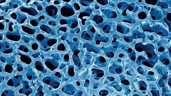 Biological and physical properties of bone block grafting biomaterials for alveolar ridge augmentation