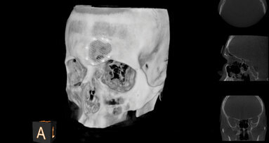 Imaging system helps gain patient acceptance and eliminate surprises