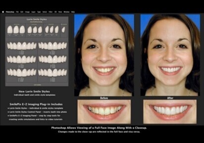 SmilePix E-Z Imaging