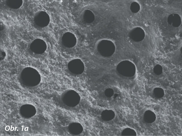 Povrch obnaženého kořenového dentinu (zvětšení 5000×): neléčeno