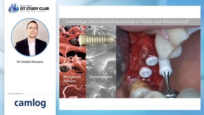 Webinar Teaser - Metallfreie Implantologie - Wunschgedanke oder klinische Realität?