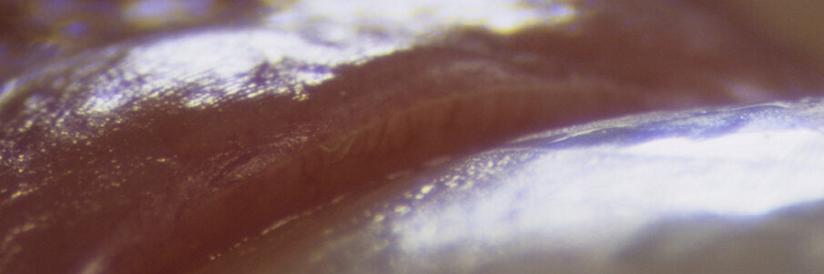 Figg. 25, 26 - Precisione marginale in bocca.