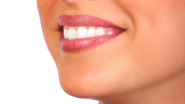 White wine can increase tooth staining