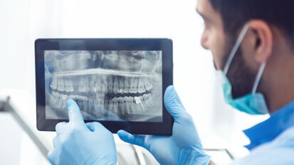 Meningeome und Schilddrüsenkrebs: Erhöhtes Risiko durch Röntgen? Meningeome und Schilddrüsenkrebs: Erhöhtes Risiko durch Röntgen?