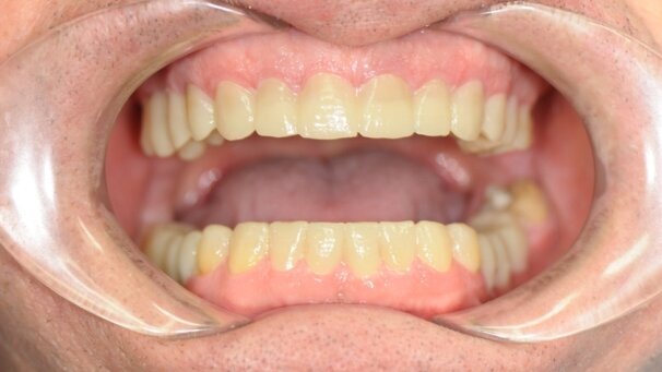 Interdyscyplinarne planowanie leczenia w stomatologii estetycznej