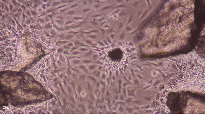 Rozemletá tvrdá zubní tkáň ve zkouškách in vitro s buňkami MG63. Je vidět afinita buněk k některým zrnům tvrdé zubní tkáně.