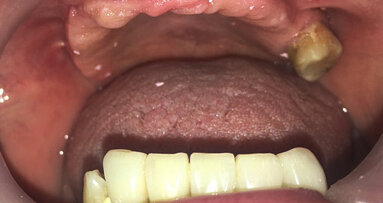 El Presidente de Brasil veta el Proyecto de Odontología Hospitalaria