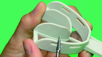 Implants + Empreintes : Compliqué ?