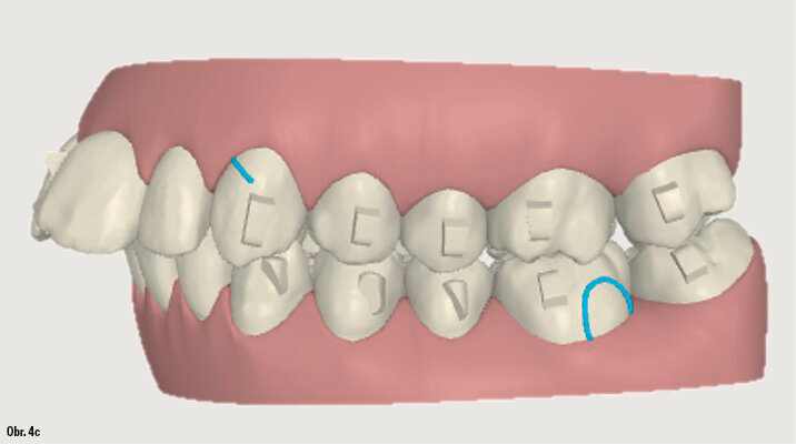 Kazuistika - popis v textu