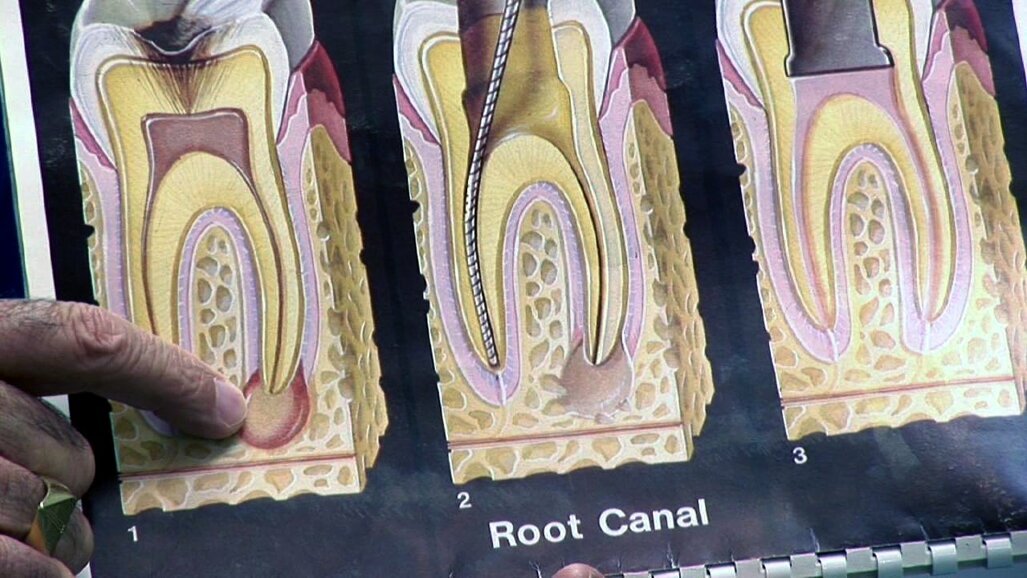 Ξεκινά την επόμενη Παρασκευή το πρώτο Συνέδριο Ενδοδοντίας και Προσθετικής