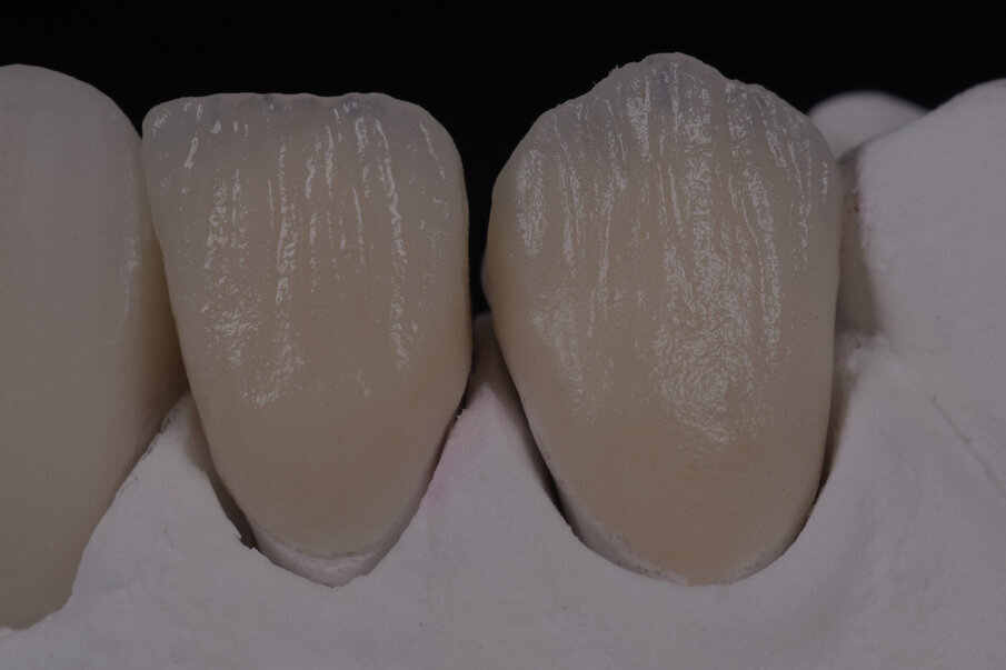 Figg. 27, 28 - Struttura interna.