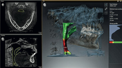 Role of dental professionals in sleep medicine