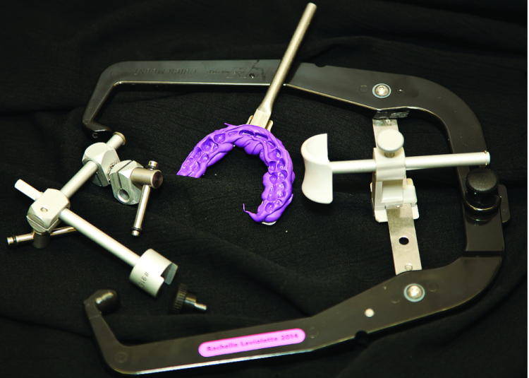 Fig. 2: Analog facebow