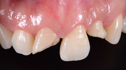 Snellire la lavorazione in laboratorio? Servono validi protocolli