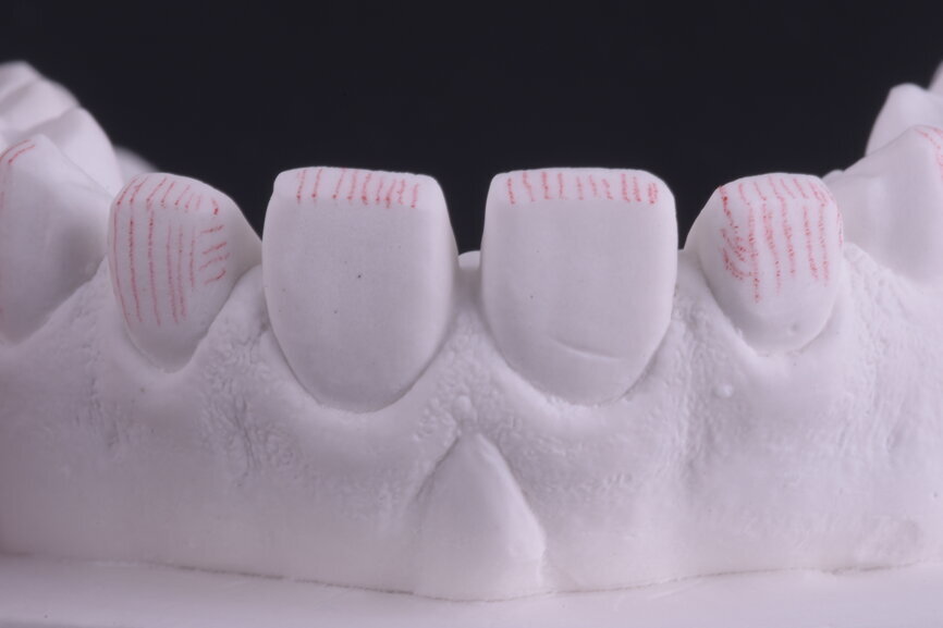 Fig. 40: Calibrated reduction completed by the laboratory and red marked areas.