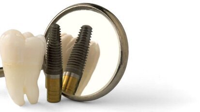 Cochrane-onderzoek: geen verschil in langetermijnsucces tussen implantaten
