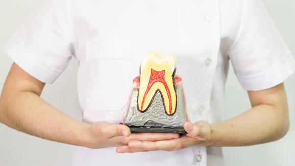 Wurzelkanalbehandlung oder doch ein Implantat?