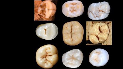 Проучване върху зъби повдига въпроси за прародителите на човека