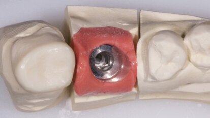 Dwuczęściowe łączniki – w przypadkach, kiedy ma to sens