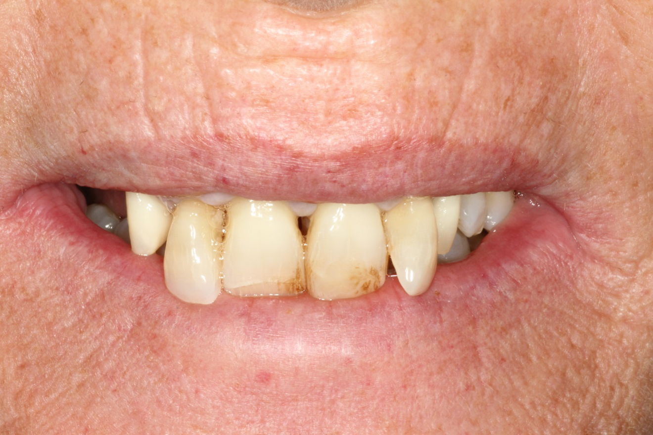 Fig. 1: Patient’s initial situation, extra-oral aspect.