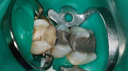 Résultats du sondage sur les systèmes de matrices sectorielles