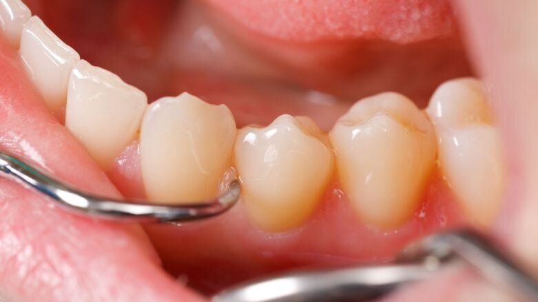 Prijzen voor ACTA-promovendi