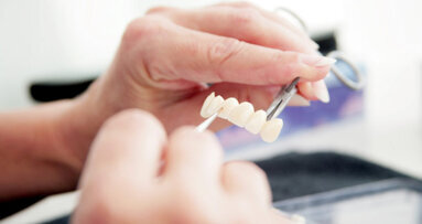 Prothesen direkt vom Zahntechnikermeister?