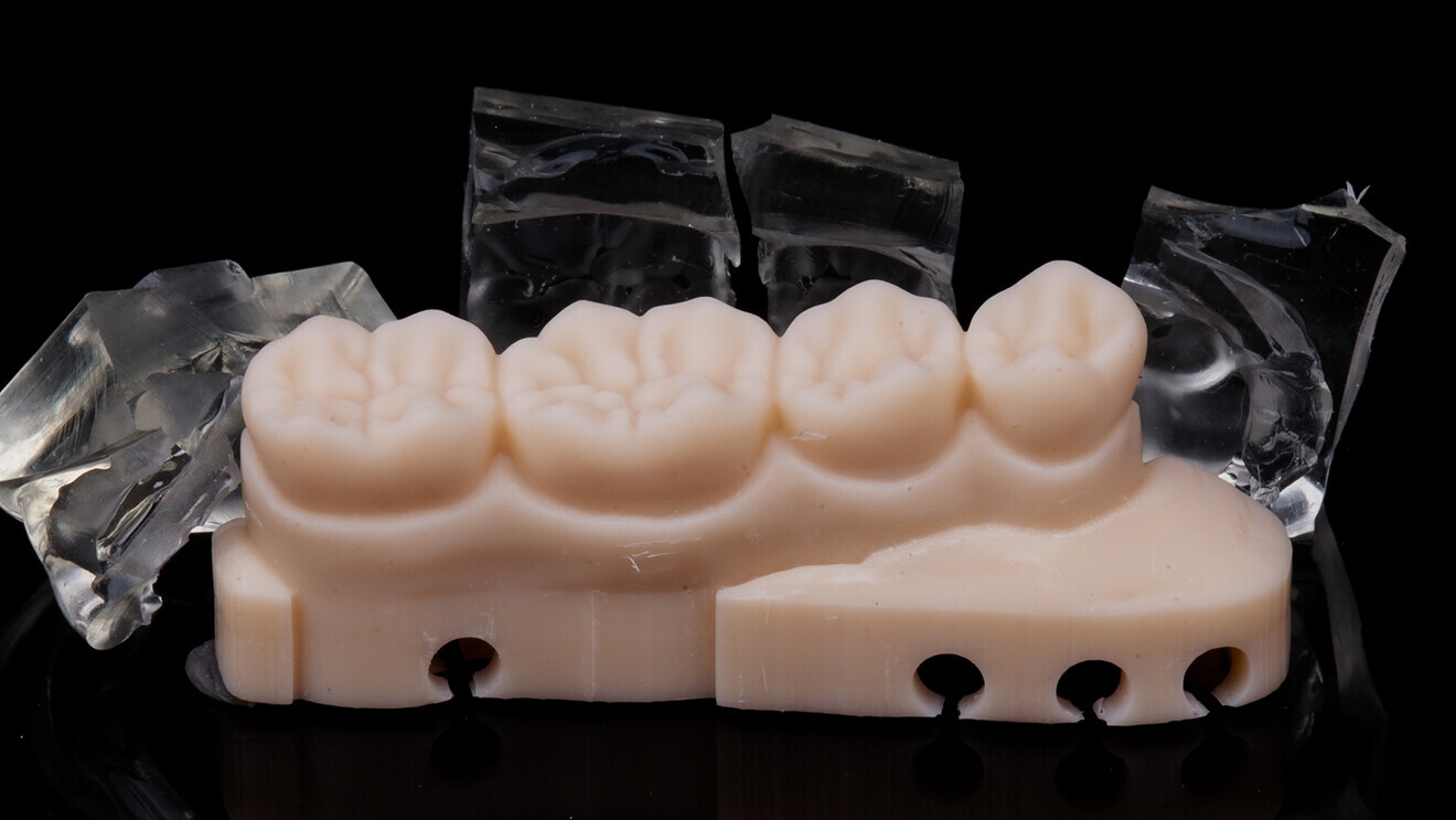 Fig. 11: Silicone index sectioned tooth by tooth.