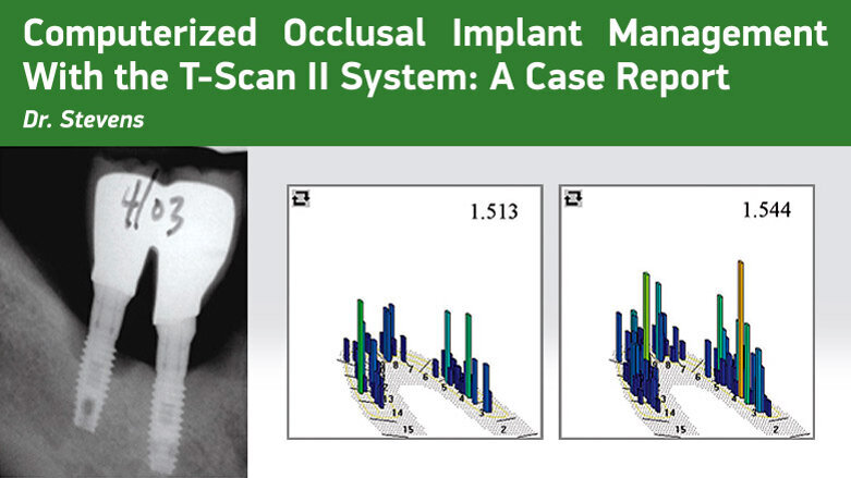 Computerized Occlusal Implant Management With the T-Scan II System: A Case Report