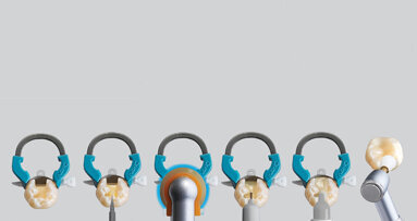 How I reduced Class II postoperative sensitivity