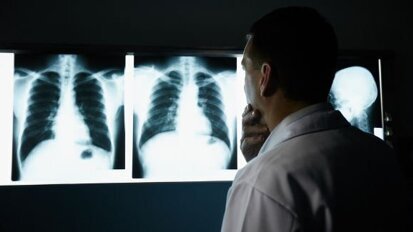 24 marca – Światowy Dzień Gruźlicy