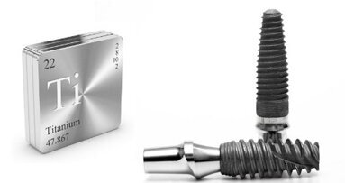 Corrosie mogelijk door titaniumimplantaten