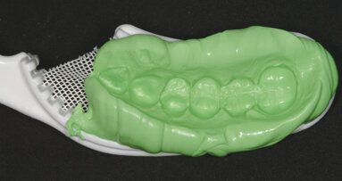 Kada zatražiti ponovno uzimanje otiska