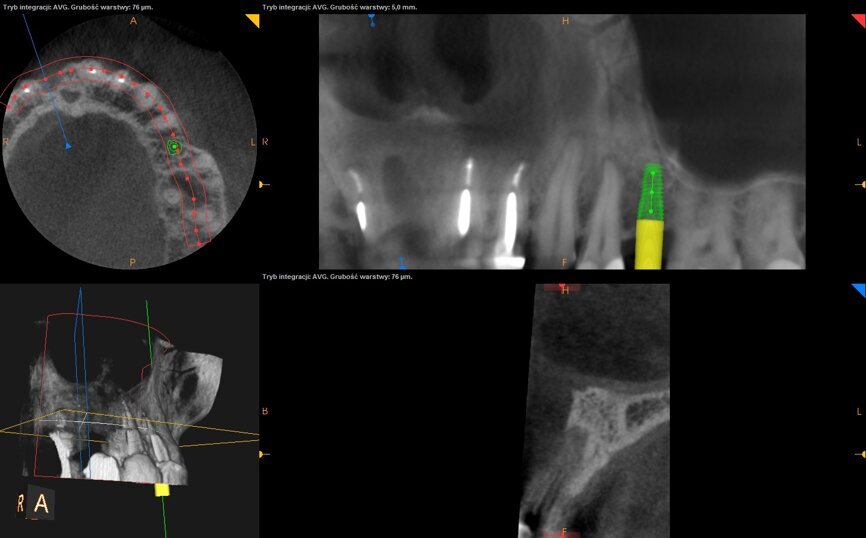 Ryc. 4_Obraz CBCT.