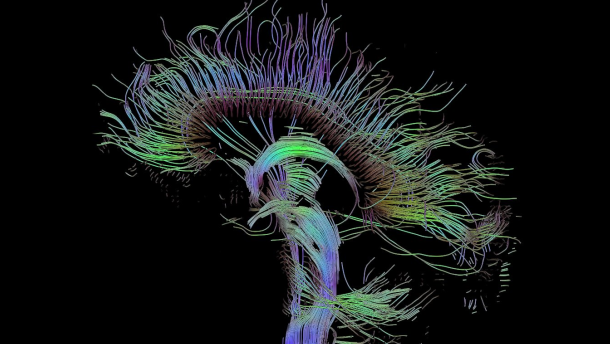 Stamcellen uit tanden kunnen veranderen in hersencellen