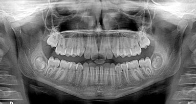 Groen licht voor taakherschikkingsexperiment