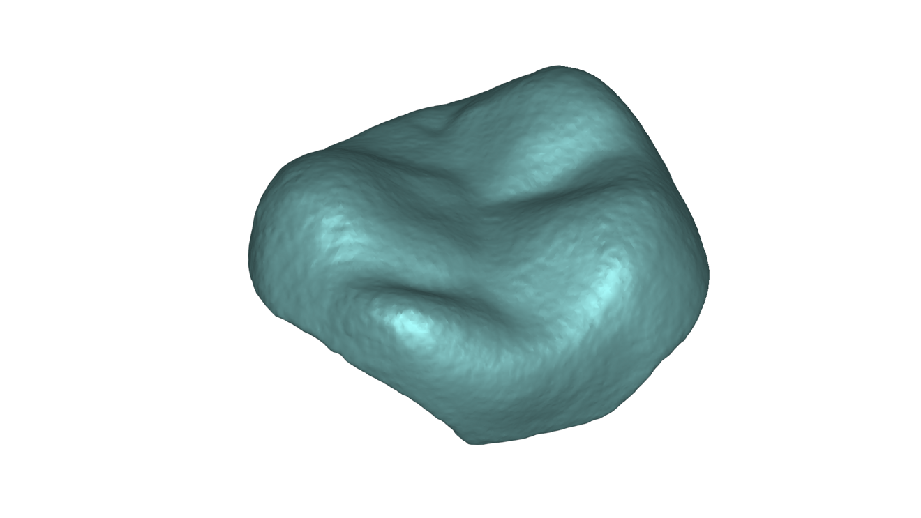 3D scan of a tooth captured with the Artec Micro II.