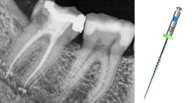 Getting to the 00.00 point