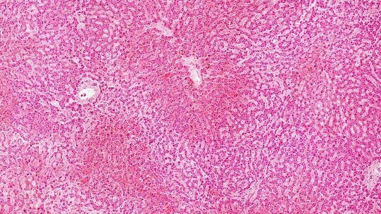 Gas koji uzrokuje neprijatan zadah omogućuje uzgoj matičnih ćelija dobijenih iz zuba