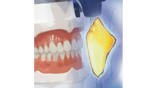 Acrylic Materials & Artificial Teeth