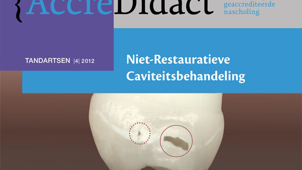 Kinderen met cariës gebaat bij NRC