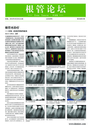 Endo Tribune China No. 1, 2014