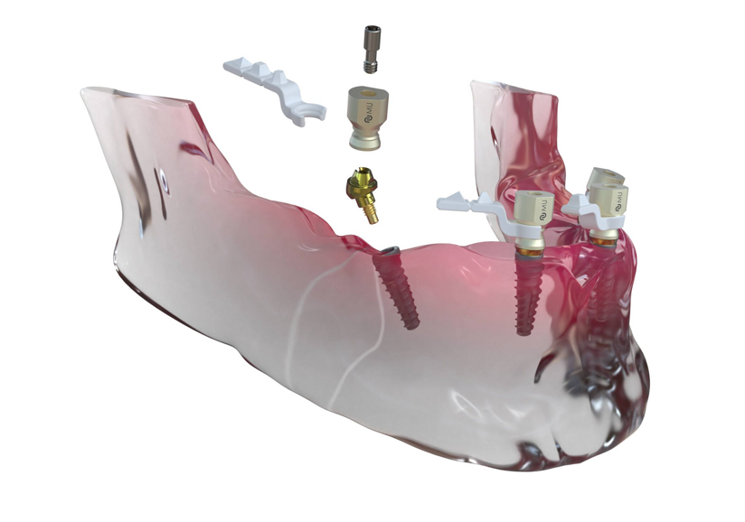 Neoss4+ treatment solution