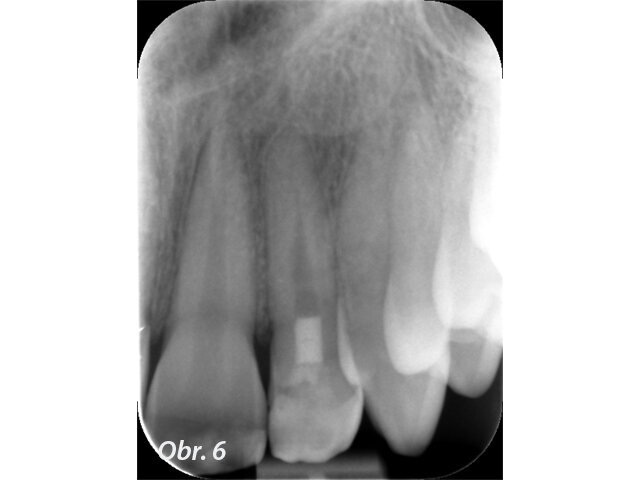 Obr. 6: Kontrola (2017)